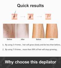 Load image into Gallery viewer, Ultrafast IPL Hair Removal Handset
